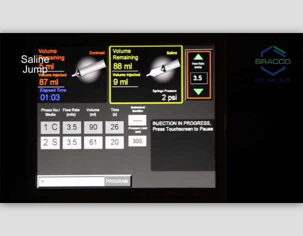 Explanation of how to reserve iodine using the Saline Jump feature on the EmpowerCTA+ Injector System